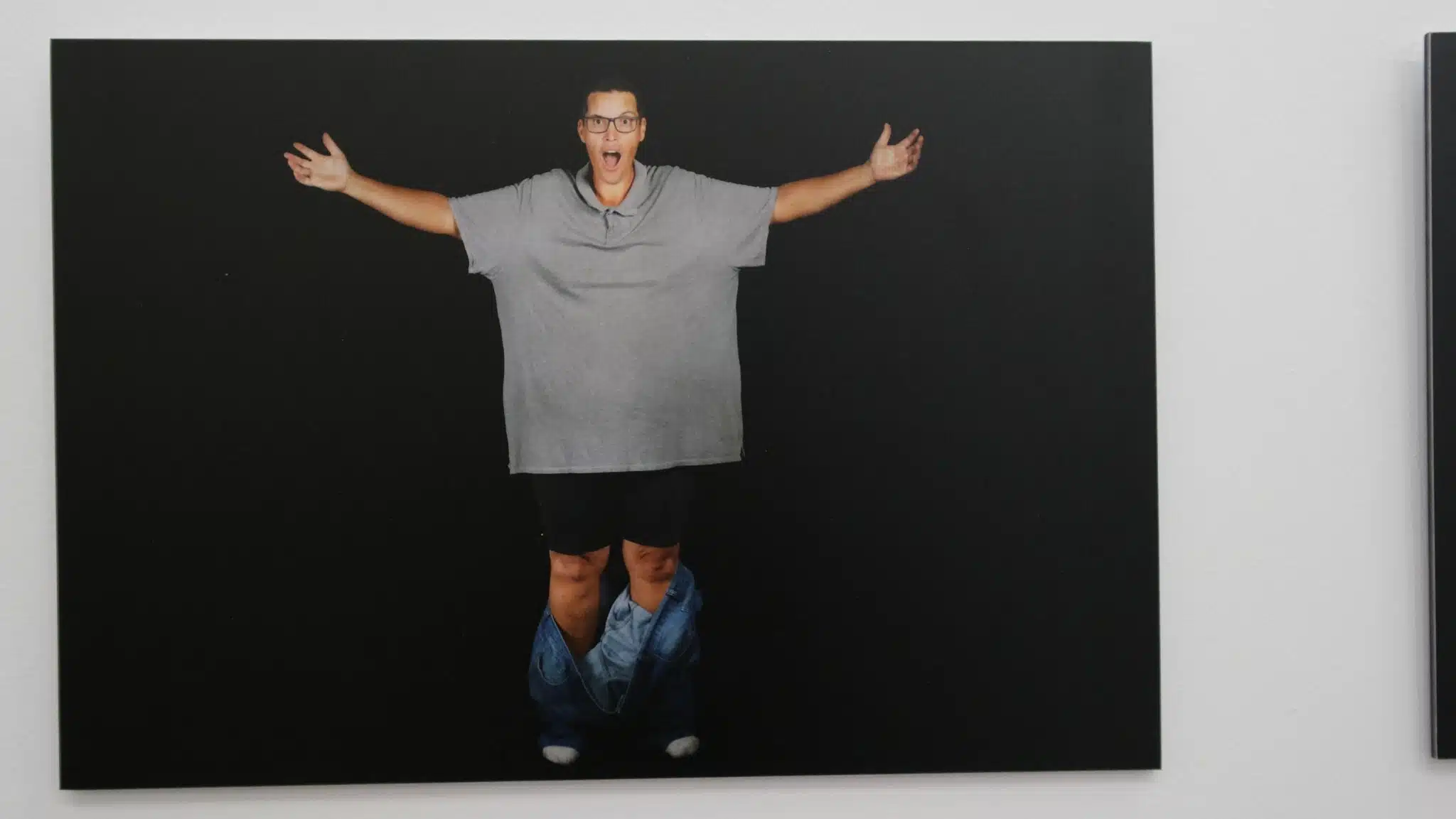 Brice expo photo Apprivoise obésité Marie Manecy CHU